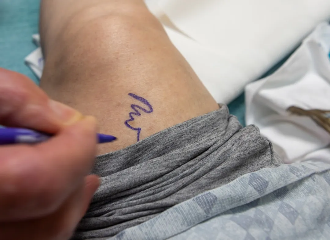 A person is writing on a patient's arm.